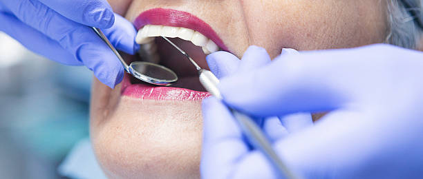 Dentist for Dental Trauma in FL